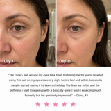 Lumere Sculpt™ 7-in-1 LED Facial & Neck Lifting Device